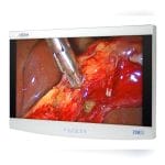 Surgical Monitor 2