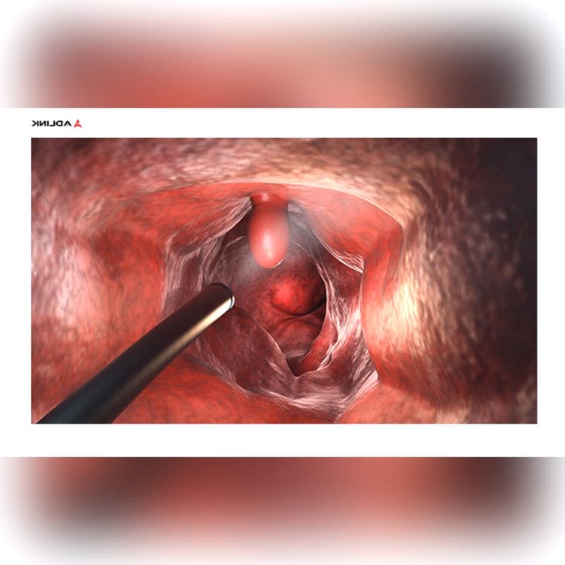 Surgical Monitor 1