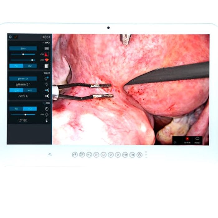 Surgical Software