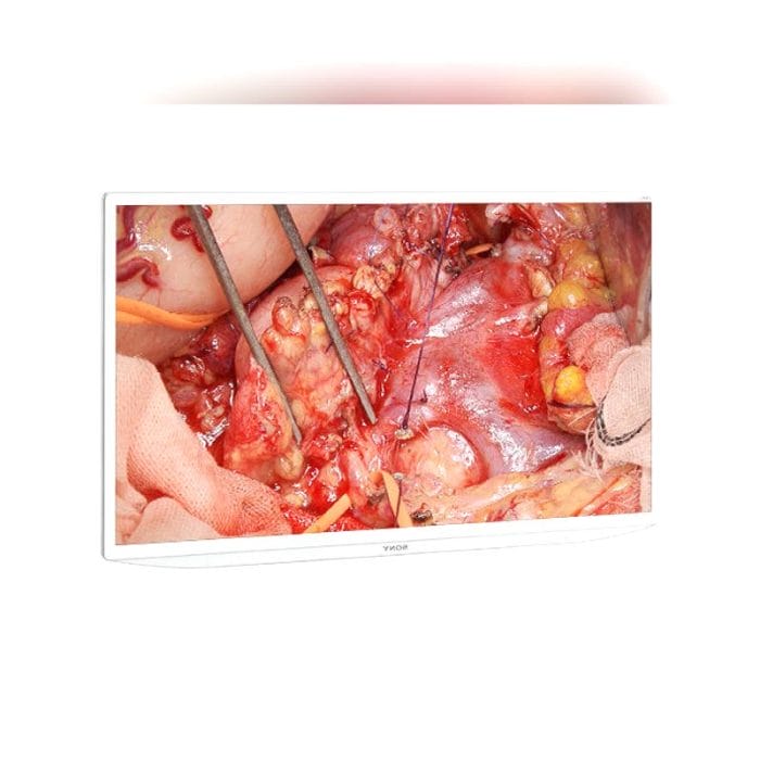 Surgical Video Recorder 9