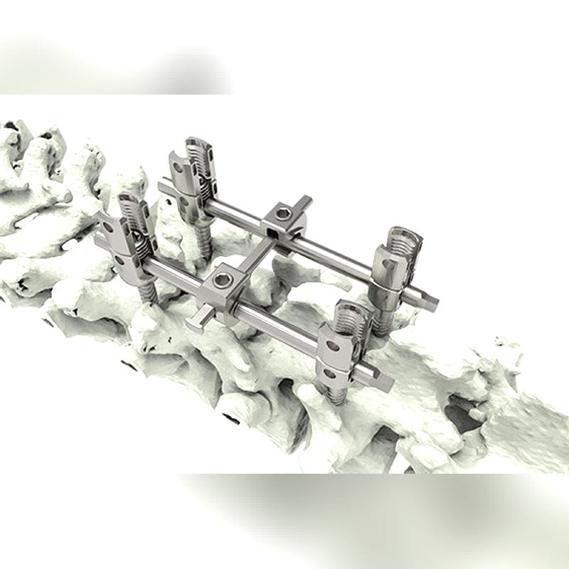 Thoraco-Lumbar Osteosynthesis Unit