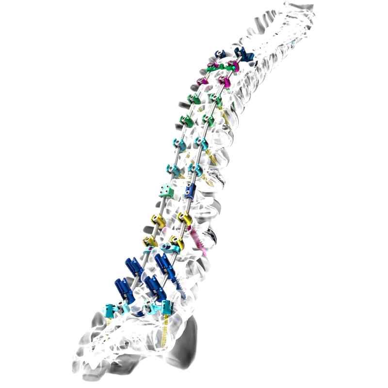 Thoraco-Lumbar Osteosynthesis Unit