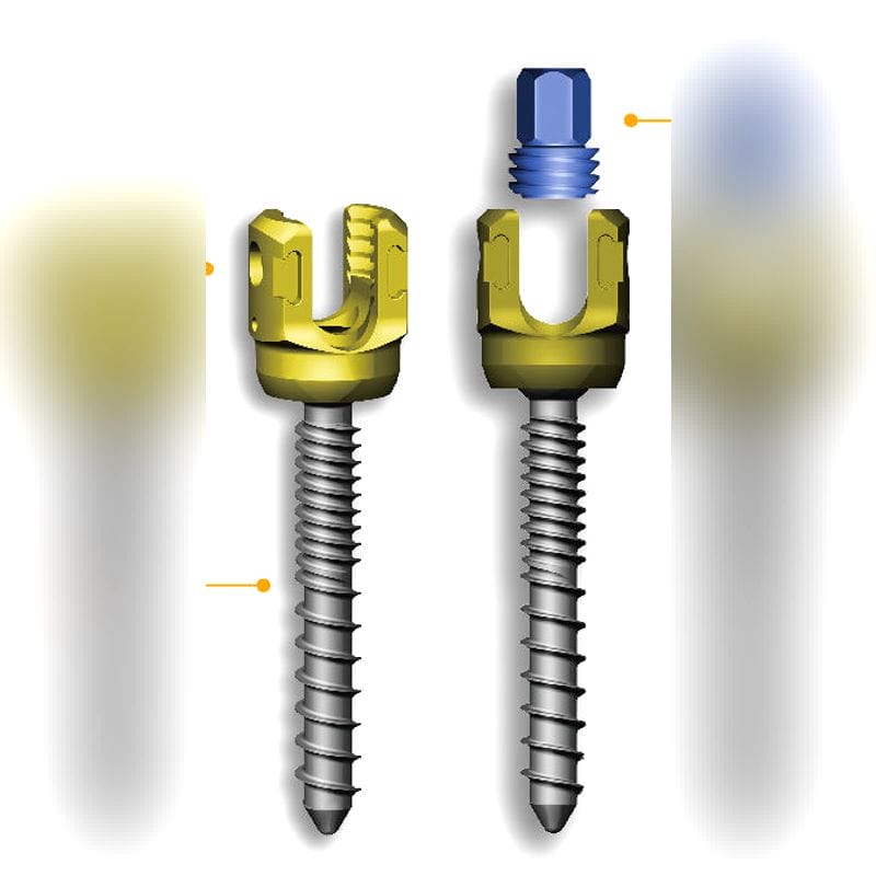 Thoraco-Lumbo-Sacral Osteosynthesis Unit 1