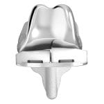 Three-Compartment Knee Prosthesis 1