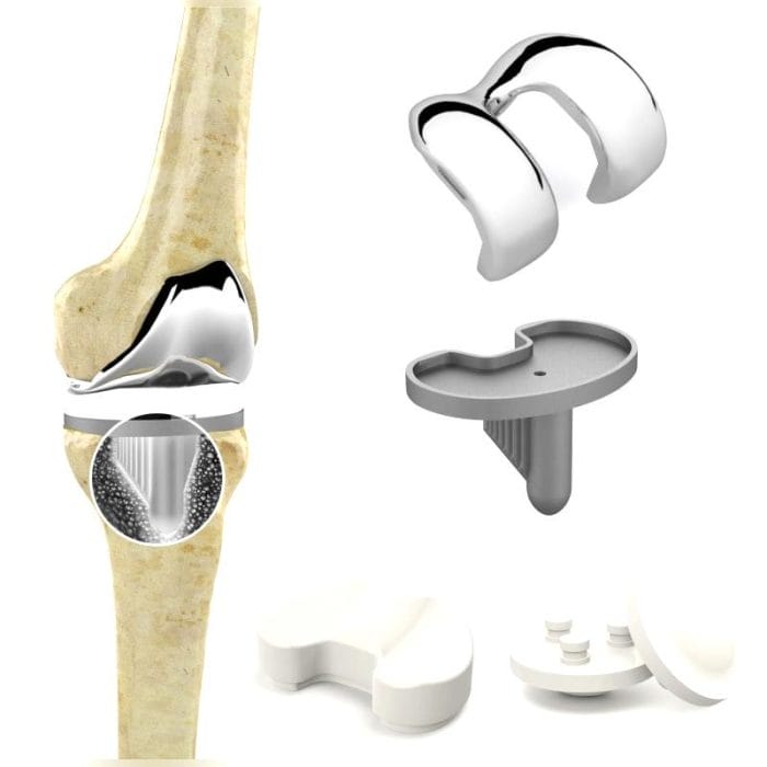 Three-Compartment Knee Prosthesis