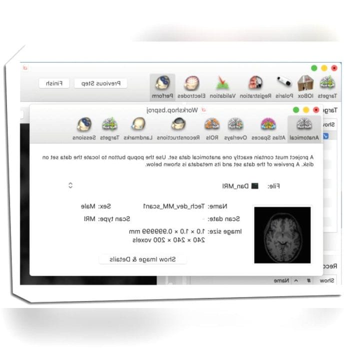 Tms Neuronavigation System 4