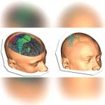 Tms Neuronavigation System 5