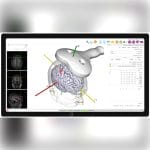 Tms Neuronavigation System 1