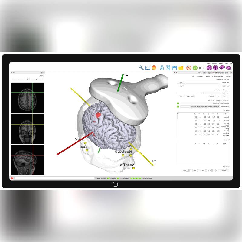 Tms Neuronavigation System 1