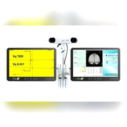 Tms Neuronavigation System 1