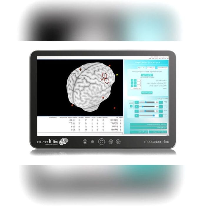 Tms Neuronavigation System 3