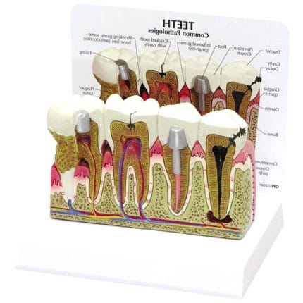 Tooth Model 1