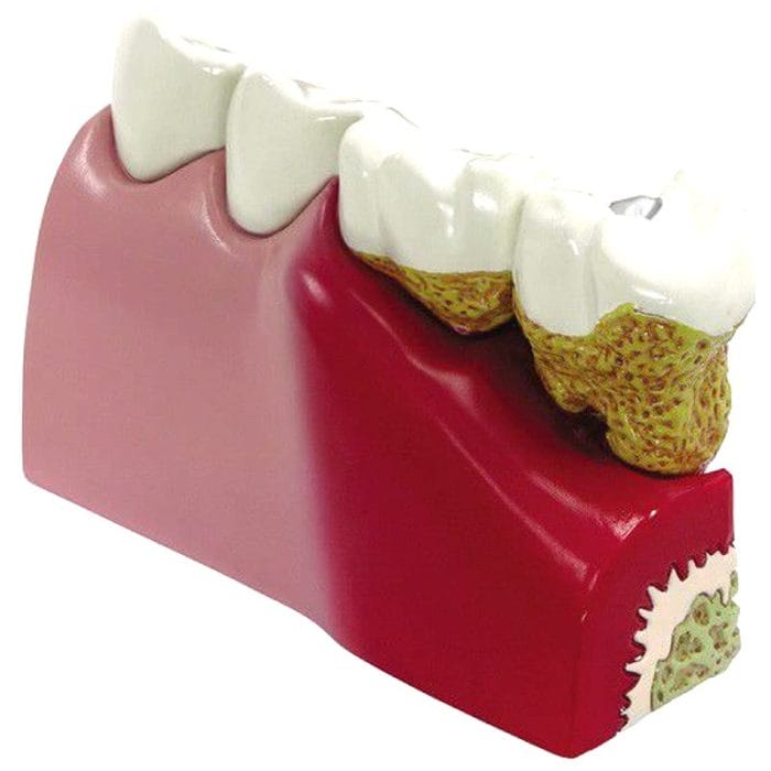 Tooth Model