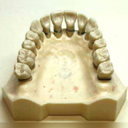 Tooth Model