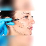 Tooth Whitening Laser 1