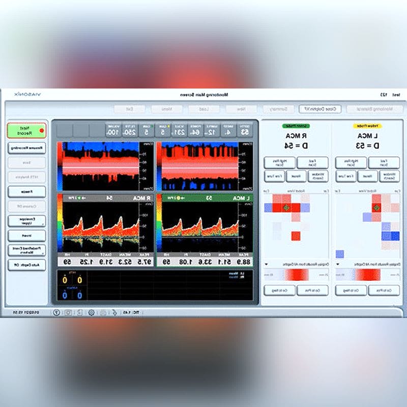 Transcranial Doppler 1