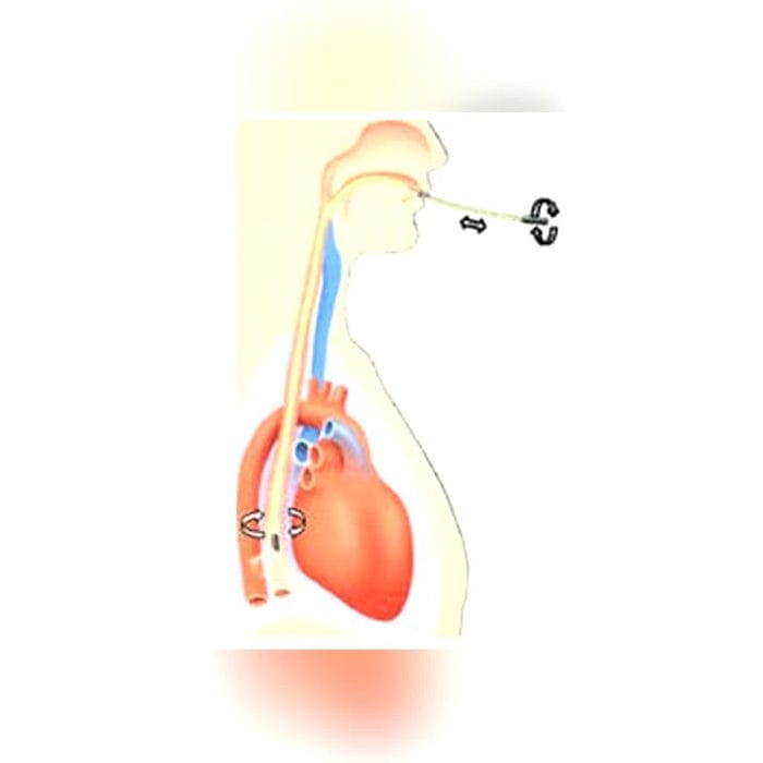 Transcranial Doppler 3