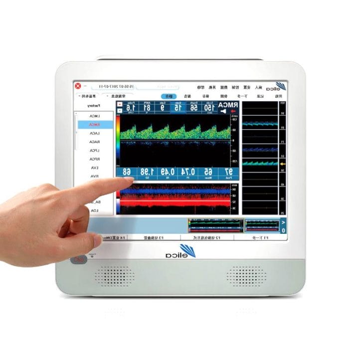 Transcranial Doppler 2