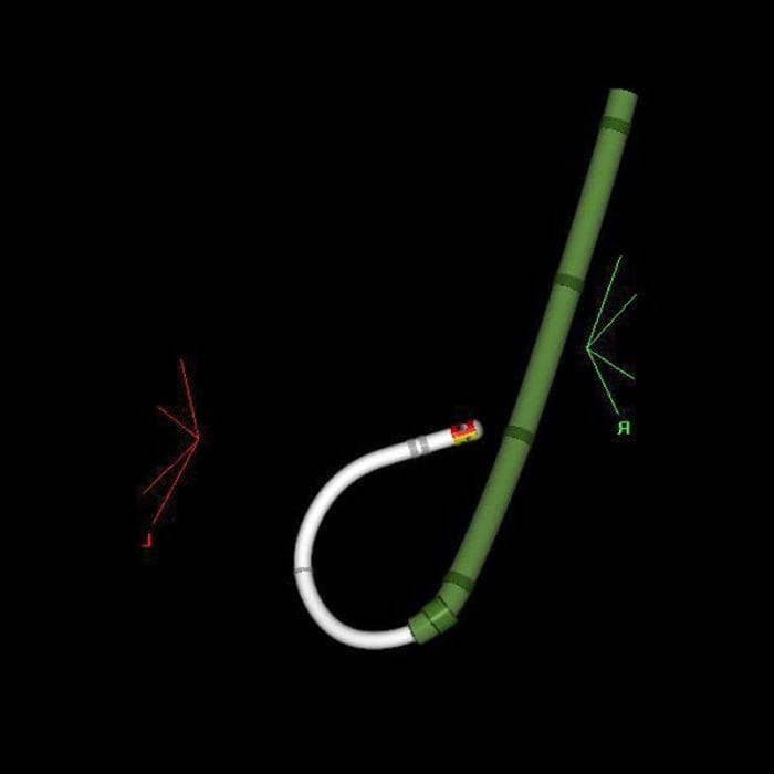 Transseptal Access Sheath 1