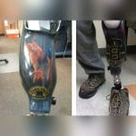 Transtibial Prosthetic Socket 1