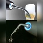 Ultrasonic Dental Scaler 4