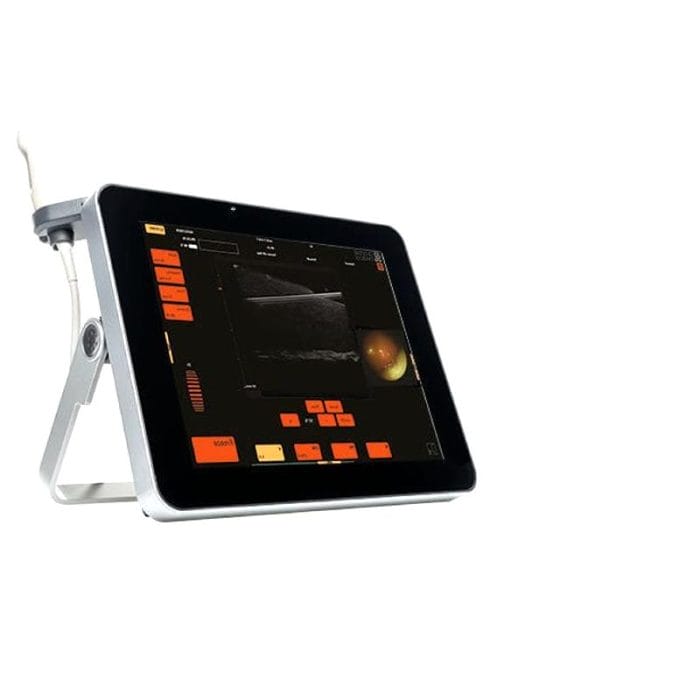 Ultrasound Endoscope 1