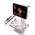 Ultrasound Endoscope