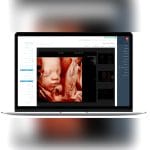 Ultrasound Imaging Software 2