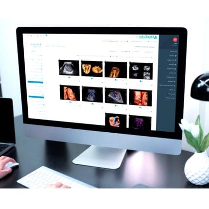 Ultrasound Imaging Software