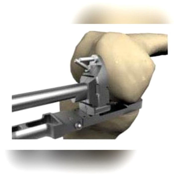 Unicompartmental Knee Prosthesis 3