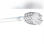 Urethral Stent 2