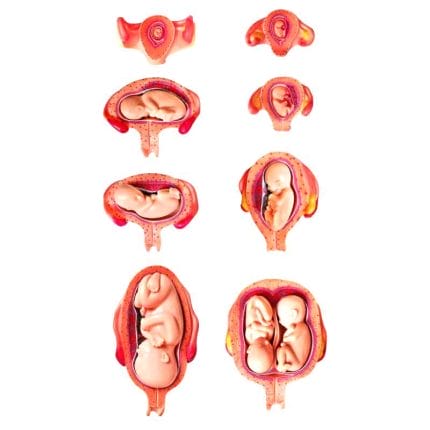 Uterus Model