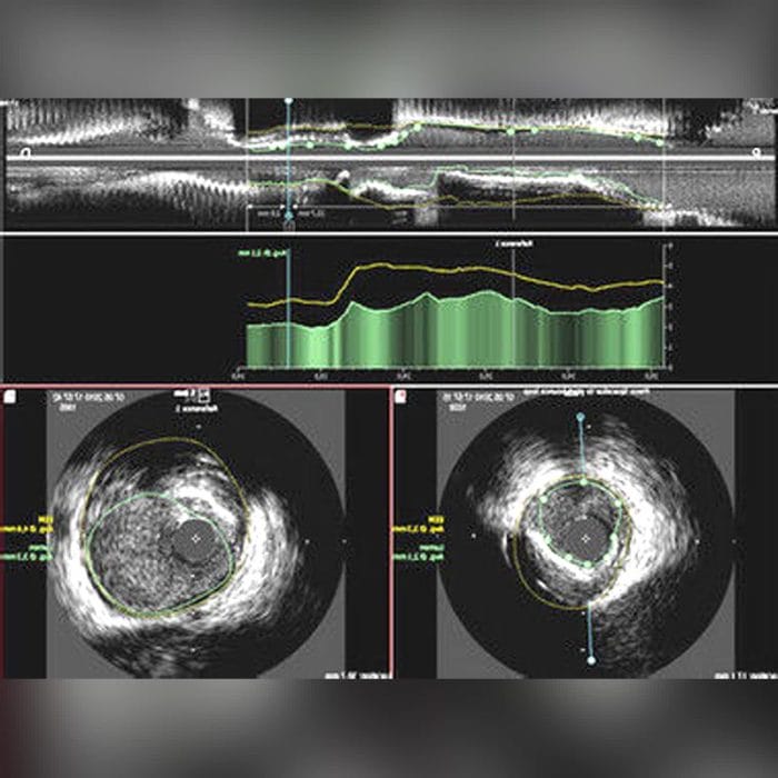 Vascular Examination Software 3