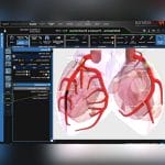 Vascular Examination Software 7