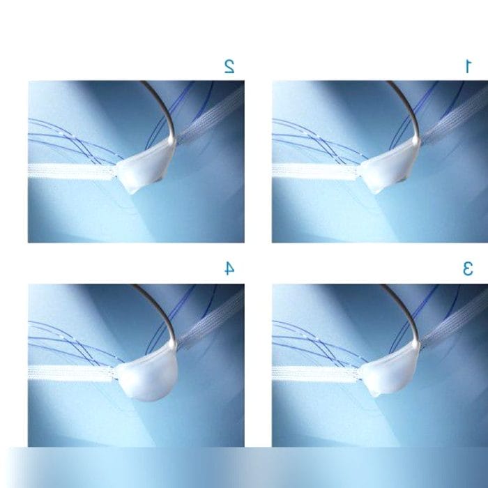 Vesical Sphincter Prosthesis 3