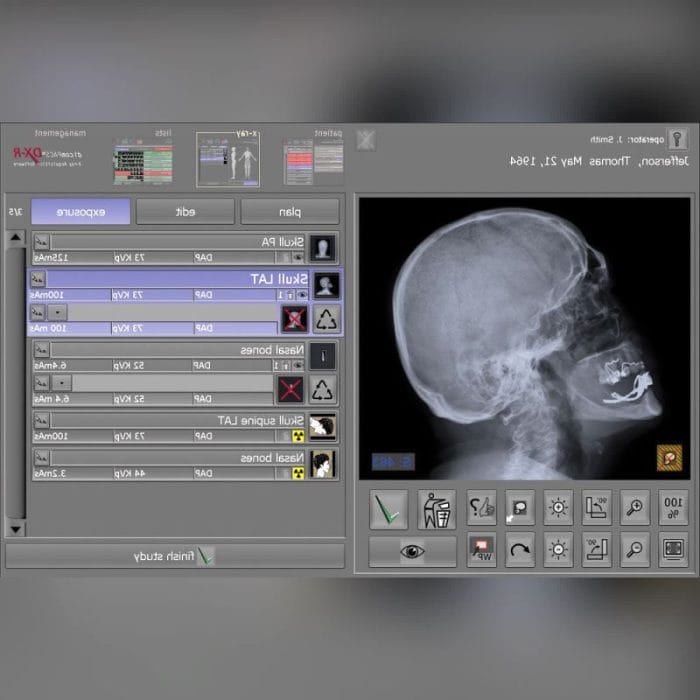 Veterinary Radiography Acquisition System 8