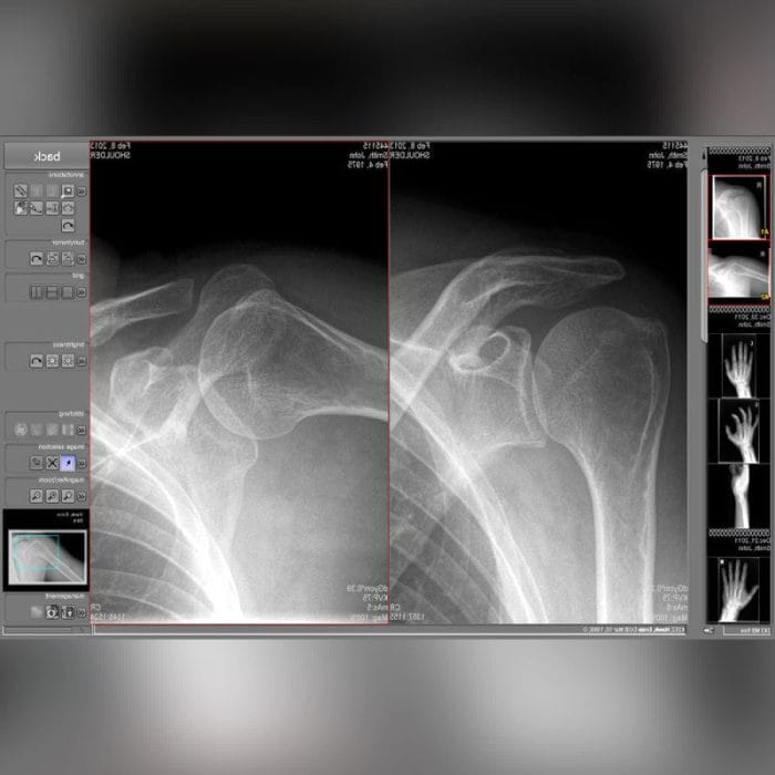 Veterinary Radiography Acquisition System 9