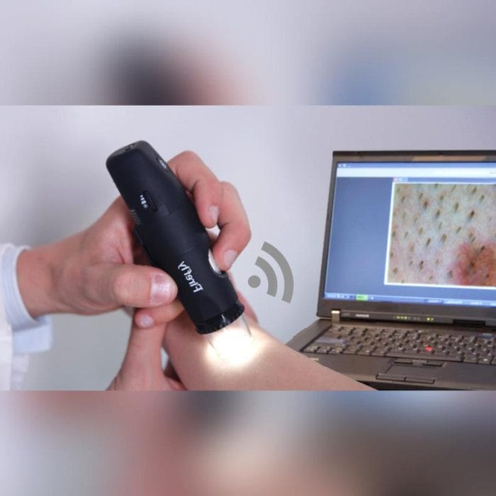 Video Dermatoscope 2