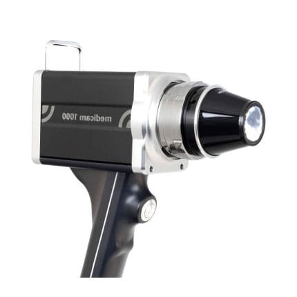 Video Dermatoscope