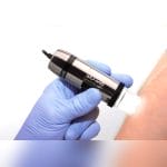 Video Dermatoscope 2