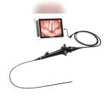 Video Laryngoscope 1