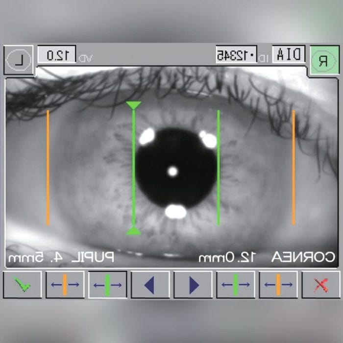 Video Pupillometer 2