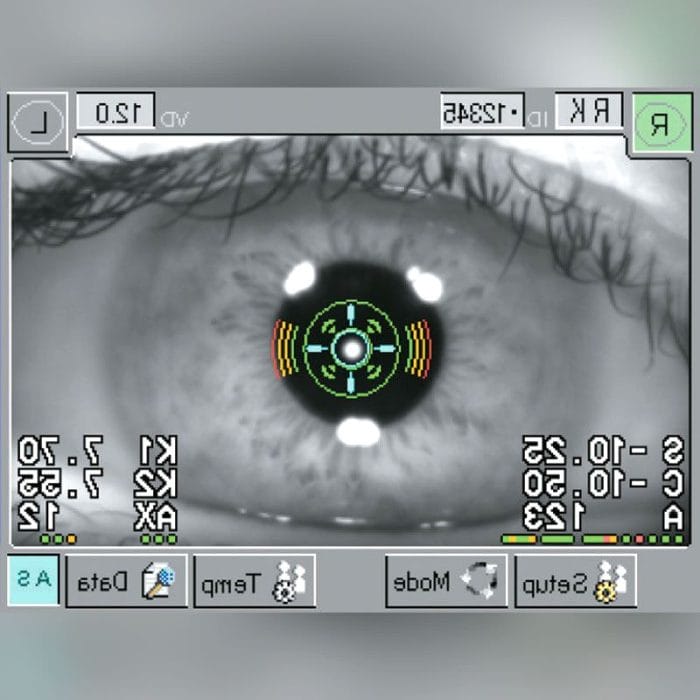 Video Pupillometer 3