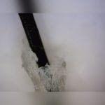 Video Trichoscope 2