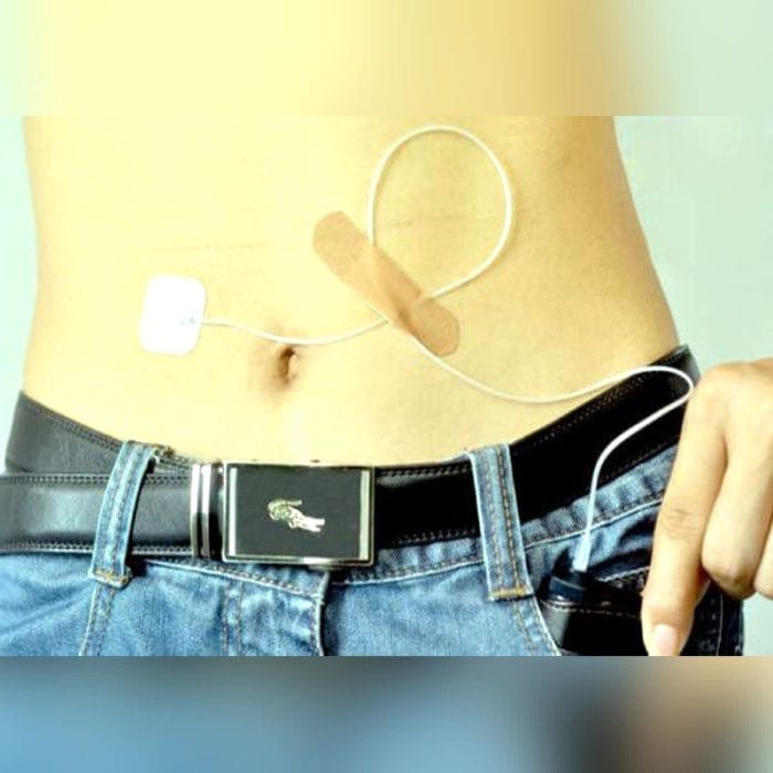 Waterproof Insulin Pump 2