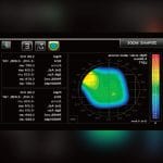 Wavefront Aberrometer 3