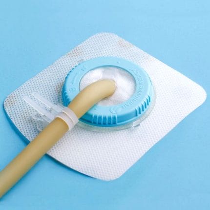 Wound Drainage Catheter Catheter Fixation