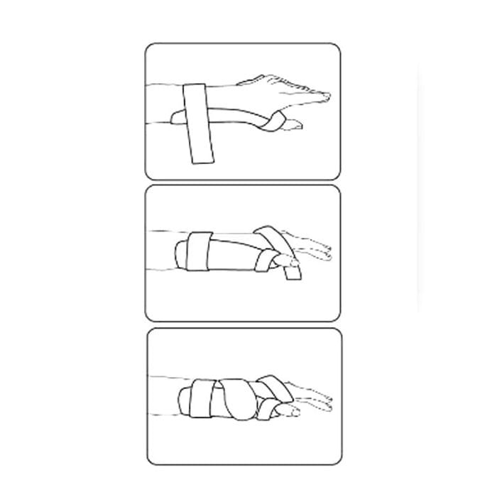 Wrist Orthosis 1