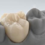 Zirconia Dental Material 1